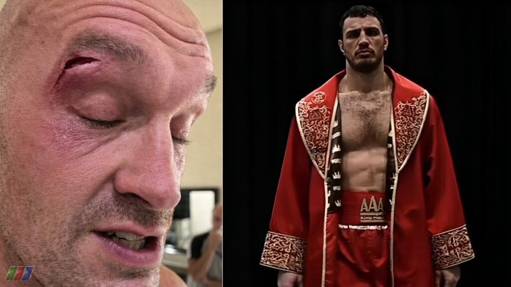 Tyson Fury's cut image side by side with Agron Smakici, who caused it