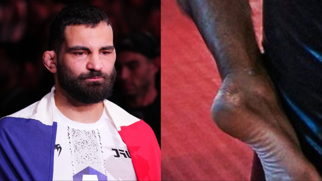 Benoit Saint-Denis addresses staph infection speculation ahead of UFC 329 Benoit Saint-Denis walks to the Octagon for his fight at UFC 325